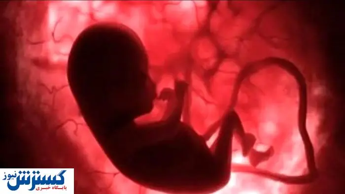 دولت شرایط سقط جنین قانونی را اعلام کرد | کدام روش بهتر است د؟ دولت شرایط سقط جنین قانونی را اعلام کرد | کدام روش بهتر است د؟_68c85ab58657a.webp