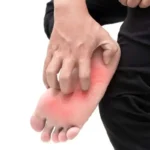 خارش کف پا؛ مشکل کوچک یا نشانه بیماری جدی؟ خارش کف پا؛ مشکل کوچک یا نشانه بیماری جدی؟_698bce25181ec.webp