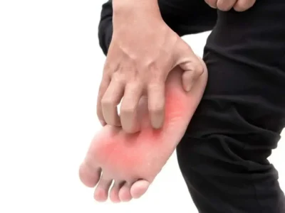 خارش کف پا؛ مشکل کوچک یا نشانه بیماری جدی؟