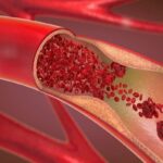 توصیه‌هایی برای دوران جنگی / روش‌های اورژانسی پیشگیری از خونریزی در مجروحان اعلام شد_69ae696456b6f.jpeg