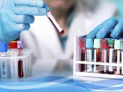 ارائه خدمات آزمایشگاهی به ۲۲ هزار نفر در تویسرکان