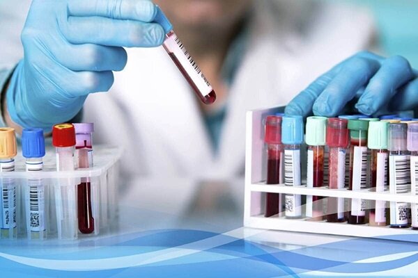 ارائه خدمات آزمایشگاهی به ۲۲ هزار نفر در تویسرکان