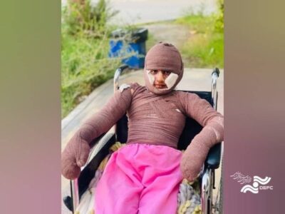 «هدا»، دختری از میناب/ مستندی درباره یکی از بازماندگان جنگ رمضان