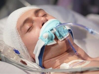 ضربه به سر ممکن است سلامت روده را مختل کند