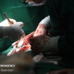 تشریح مهم ترین چالش های پیوند ریه در ایران تشریح مهم ترین چالش های پیوند ریه در ایران_6aa55657c73ba.jpeg