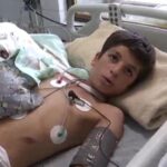 یک جراحی کم‌نظیر در بروجرد؛ دست قطع‌شده نوجوان دوباره به بدن بازگشت_6aa404d719fdf.jpeg